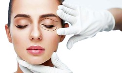 Phẫu thuật thẩm mỹ cho người nước ngo&#224;i: Việt Nam đang tiến những bước d&#224;i 