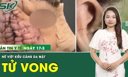 Những th&#244;ng tin y tế nổi bật ng&#224;y 17/3