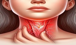 C&#226;u hỏi thường gặp li&#234;n quan đến bệnh vi&#234;m họng