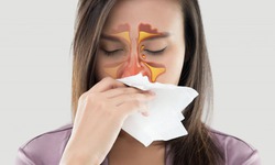 Bất ngờ với biến chứng nguy hiểm của vi&#234;m đa xoang nhiều người chưa biết