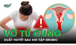 Sau tập Erobic c&#244; g&#225;i 26 tuổi bị vỡ nang buồng trứng
