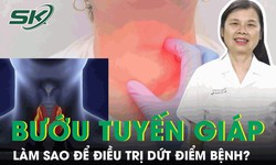 L&#224;m sao để điều trị dứt điểm bệnh bướu tuyến gi&#225;p?