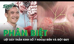 C&#225;ch ph&#226;n biệt liệt d&#226;y thần kinh số 7 ngoại bi&#234;n v&#224; đột qụy