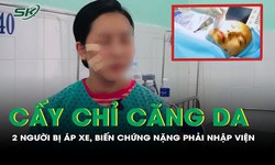 Cấy chỉ căng da, 2 người bị &#225;p xe, biến chứng nặng