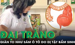 Bệnh nhi 13 tuổi đại tr&#224;ng gi&#227;n to như săm &#244; t&#244; v&#236; dị tật bẩm sinh