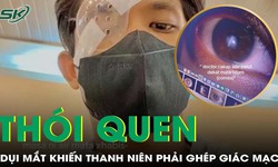 Nam thanh ni&#234;n 21 tuổi phải gh&#233;p gi&#225;c mạc v&#236; th&#243;i quen dụi mắt qu&#225; nhiều