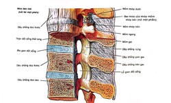 C&#225;c phương ph&#225;p trị tho&#225;t vị đĩa đệm