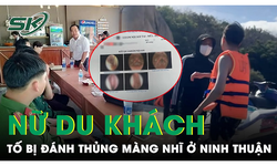 X&#225;c minh vụ nữ du kh&#225;ch tố bị đ&#225;nh thủng m&#224;ng nhĩ ở Ninh Thuận