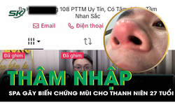 VIDEO: Th&#226;m nhập spa g&#226;y biến chứng mũi cho nam thanh ni&#234;n 27 tuổi