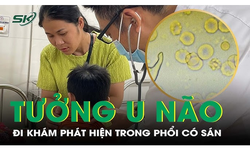 Tưởng u n&#227;o, đi kh&#225;m b&#233; trai 7 tuổi được ph&#225;t hiện trong phổi c&#243; s&#225;n