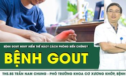 Bệnh gout nguy hiểm như thế n&#224;o? C&#225;ch ph&#242;ng biến chứng?