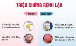 20 triệu chứng bệnh lậu ở nam, nữ giới thường gặp