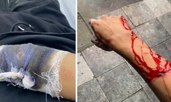 Đi xem b&#243;ng đ&#225; về l&#250;c rạng s&#225;ng bất ngờ bị ch&#233;m