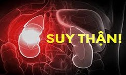 C&#225;c yếu tố l&#224;m tăng nguy cơ suy thận