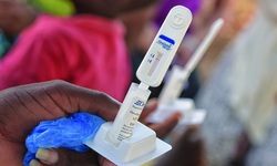 Những bước tiến mới trong ph&#242;ng chống HIV/AIDS