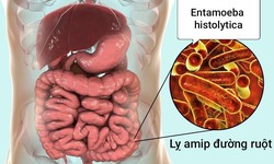 Lỵ amip đường ruột: Nguy&#234;n nh&#226;n, triệu chứng, điều trị v&#224; c&#225;c biện ph&#225;p ph&#242;ng ngừa