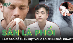 L&#224;m sao để ph&#226;n biệt s&#225;n l&#225; phổi với c&#225;c bệnh phổi kh&#225;c?