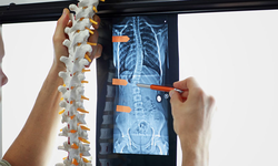 Nên làm gì khi bị đau cột sống thắt lưng?