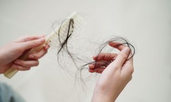 6 nh&#243;m chất n&#234;n bổ sung để tr&#225;nh rụng t&#243;c