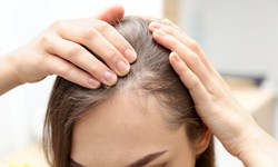 Bất ngờ, 2 loại đồ uống gi&#250;p ngăn ngừa rụng t&#243;c v&#224;o m&#249;a thu