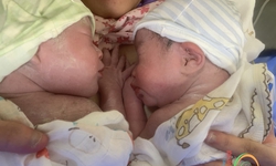 Ca song sinh ch&#224;o đời hiếm gặp ở Quảng Ninh c&#242;n nguy&#234;n trong bọc ối