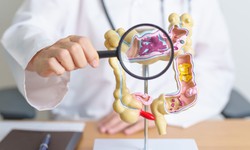 Phát triển máy in sinh học siêu nhỏ có thể chữa lành loét dạ dày