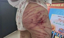 H&#224;nh vi bạo h&#224;nh trẻ em sẽ bị xử l&#253; như thế n&#224;o? 