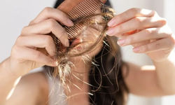 5 nguy&#234;n nh&#226;n g&#226;y rụng t&#243;c h&#224;ng đầu v&#224; c&#225;ch chữa tại nh&#224;