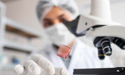 Liệu c&#243; thể chữa ung thư bằng c&#225;ch điều chỉnh vi sinh trong m&#244; u?