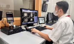 Chụp CT to&#224;n th&#226;n ph&#225;t hiện sớm ung thư, đột quỵ: B&#225;c sĩ khuyến c&#225;o g&#236;? 