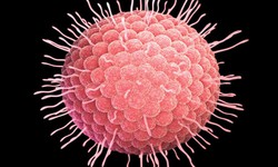 Bệnh thủy đậu ở người lớn c&#243; thể g&#226;y biến chứng nguy hiểm