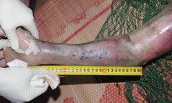 Truy t&#236;m tung t&#237;ch nạn nh&#226;n nổi tr&#234;n s&#244;ng, tr&#234;n tay xăm chữ &#39;I love you&#39;