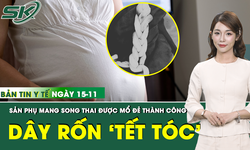 Bản Tin Y Tế 15/11: Mổ lấy thai thành công cho sản phụ mang song thai với dây rốn xoắn chặt