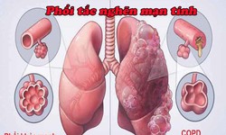Nhận biết bệnh&#160;phổi&#160;tắc&#160;nghẽn&#160;mạn&#160;t&#237;nh