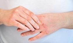 Sai lầm phổ biến khiến da bong tróc và nứt nẻ khi dùng máy sưởi mùa lạnh