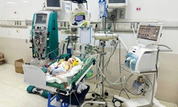 Cứu sống trẻ sơ sinh bị sốc nhiễm khuẩn do vi&#234;m ph&#250;c mạc, thủng ruột