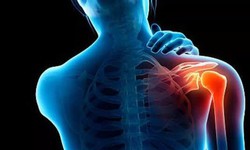 Bài tập nào giảm đau vai nhanh?