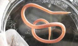 Giun đũa ở người gây biến chứng nguy hiểm gì, khám ở đâu?