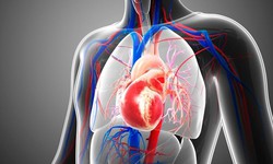 Van tim tổn thương nặng do biến chứng thấp tim
