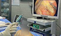 Ca phẫu thuật &#237;t x&#226;m lấn t&#225;i tạo v&#250; đầu ti&#234;n ở người gh&#233;p thận tại Việt Nam