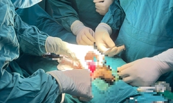 Bảo tồn thành công tinh hoàn bị xoắn cho thiếu niên đã qua 'thời gian vàng'