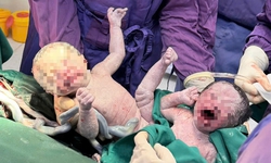 Cứu người phụ nữ bị tiền sản giật cùng 2 bé trai song sinh