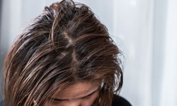 Vì sao mùa đông tóc nhanh bết hơn?