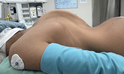 H&#224;nh tr&#236;nh nắn lại &#39;xương sống khủng long&#39; cho hai b&#233; g&#225;i