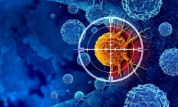 Công nghệ hình ảnh siêu nhạy giúp phát hiện ung thư sớm