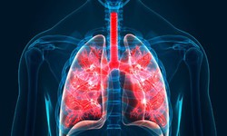 5 triệu chứng thường gặp của bệnh xơ phổi