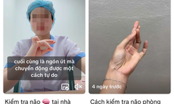 B&#225;c sĩ tim mạch giải đ&#225;p về clip hướng dẫn kiểm tra đột quỵ bằng ng&#243;n tay triệu view tr&#234;n mạng x&#227; hội
