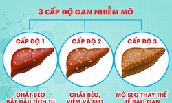 Hai cách đơn giản giúp bảo vệ gan khỏe mạnh mỗi ngày