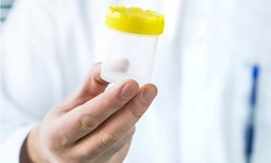 Tinh dịch đổi màu: Dấu hiệu bệnh lý không thể chủ quan