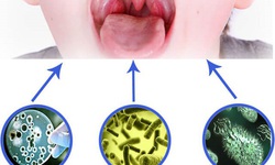 C&#225;ch chăm s&#243;c  trẻ bị vi&#234;m mũi họng cấp khi giao m&#249;a